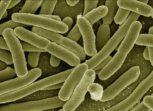 Escherichia coli koja jede CO2