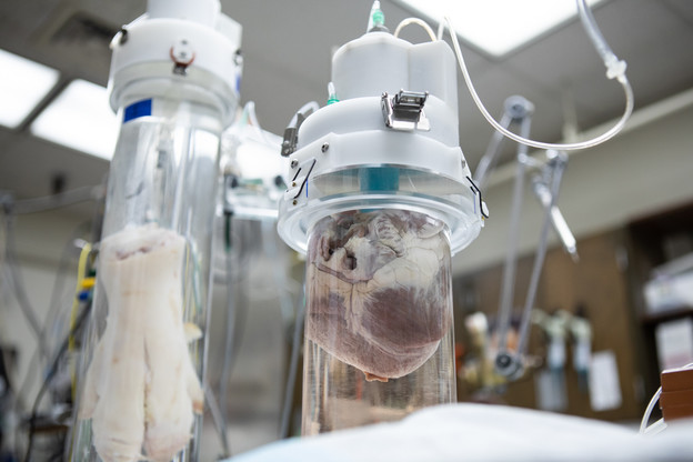 Uređaj produžava život doniranim organima