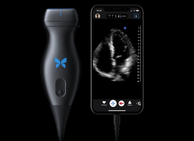 VIDEO: Ultrazvučni pregled gadgetom za iPhone